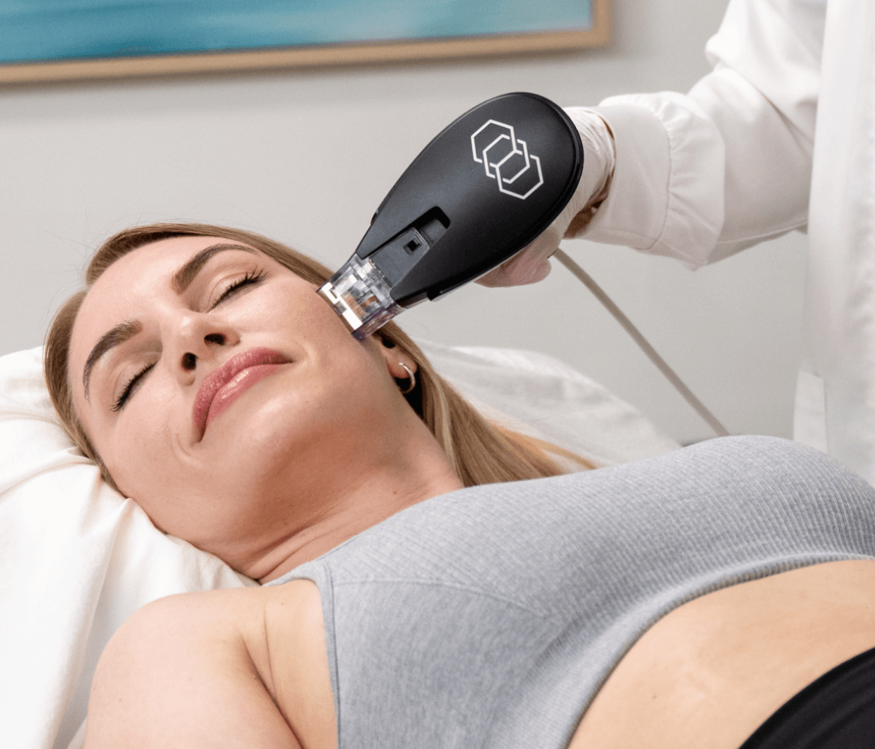 Skin tightening Morpheus8 Burst Miami- Cover