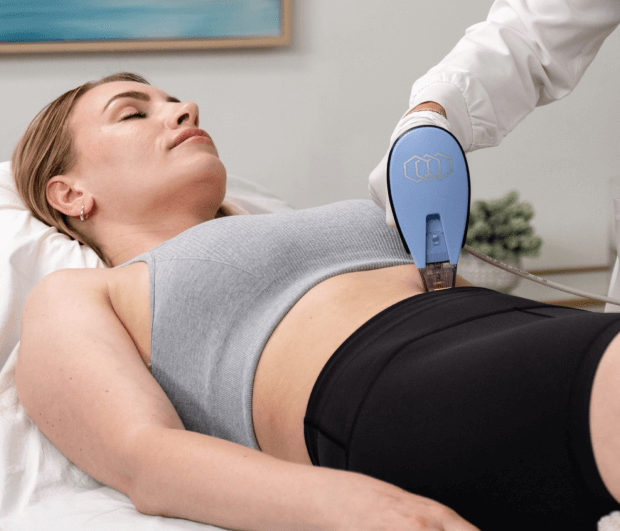 Skin tightening Morpheus8 Deep Burst Miami- Cover